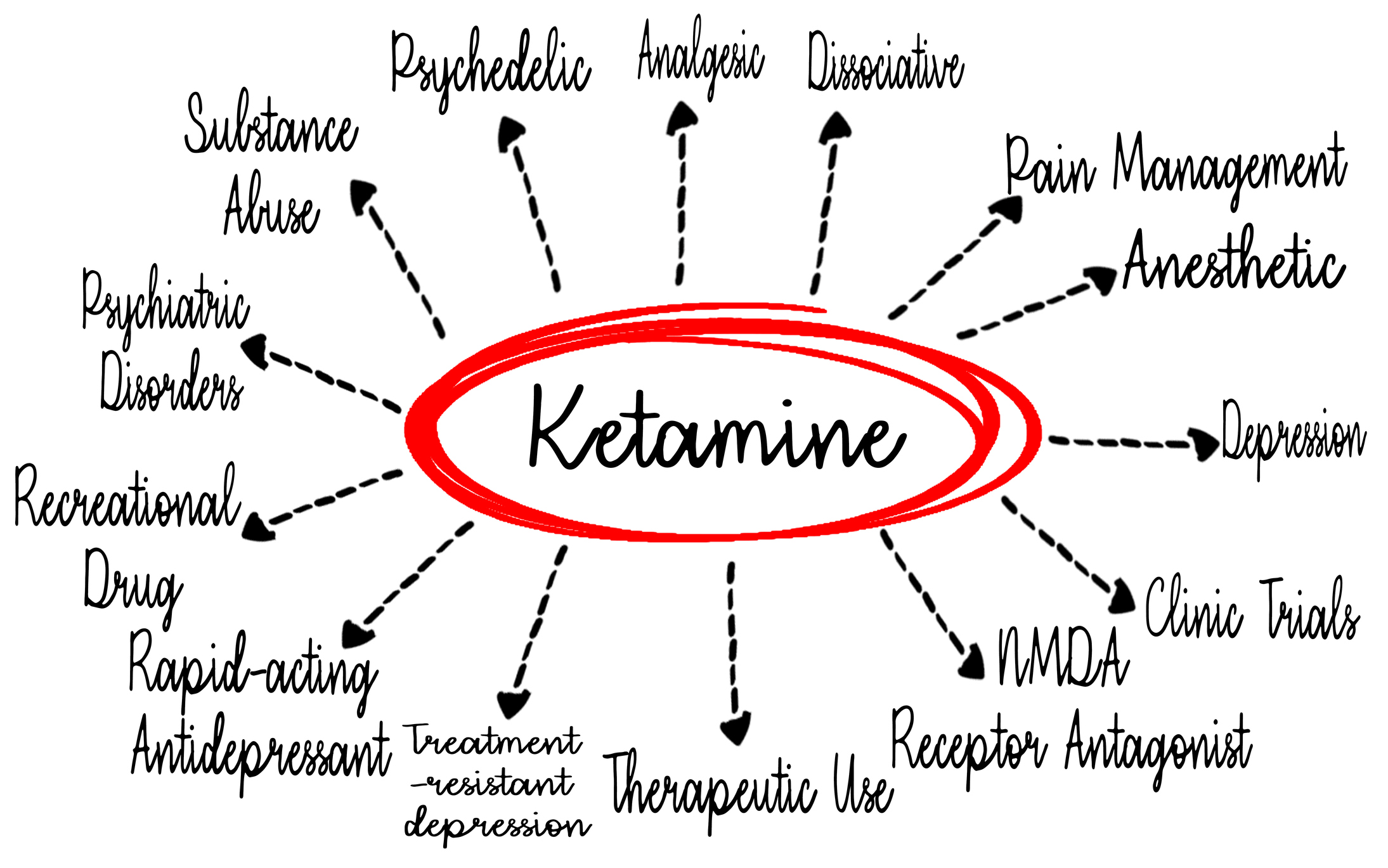 Ketamine Doctor in Boynton: Why Allay’s Experts Lead in Mental Health Care