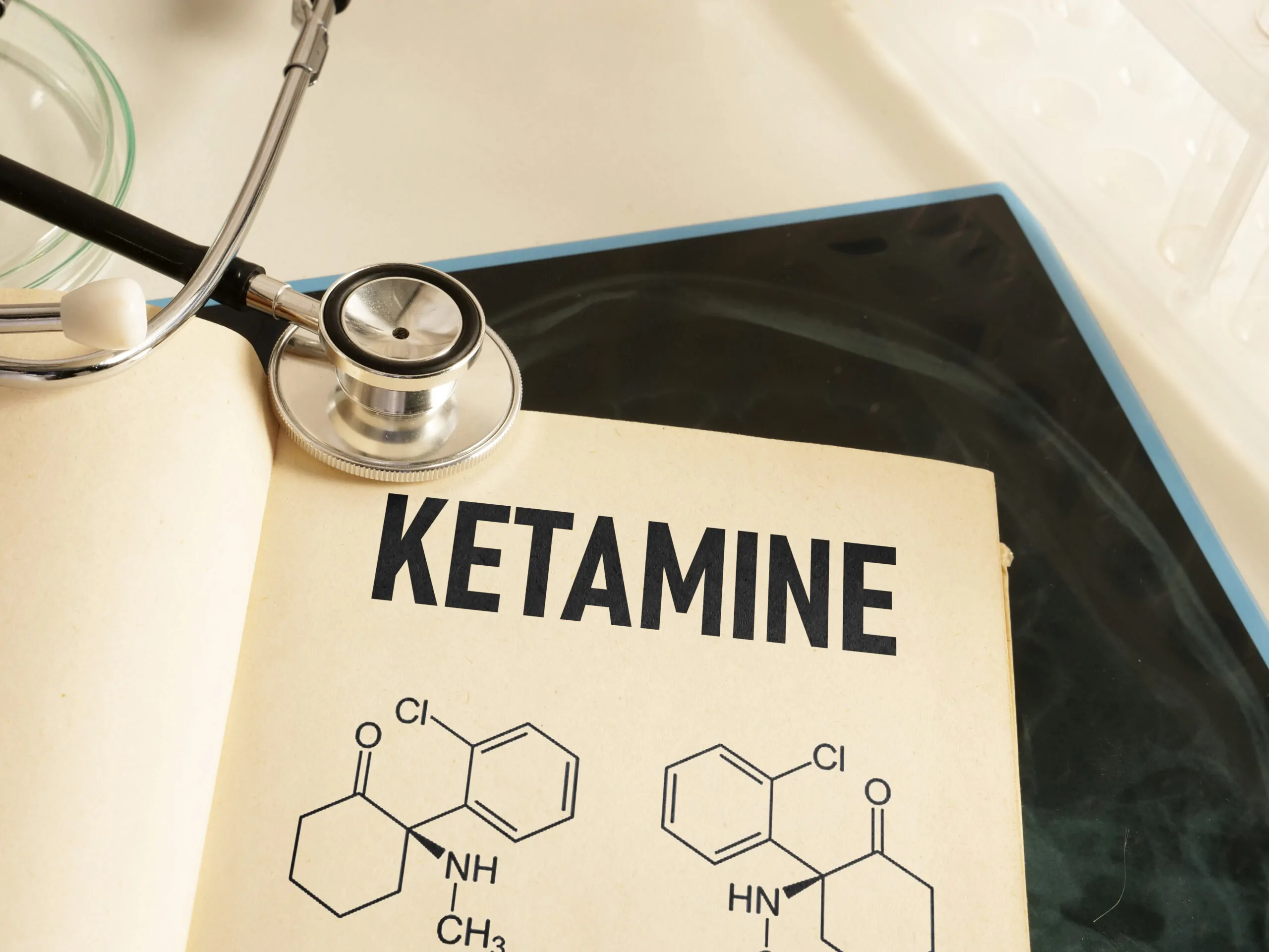 Ketamine Doctor West Palm Beach – Breakthrough Treatment for Mental Health